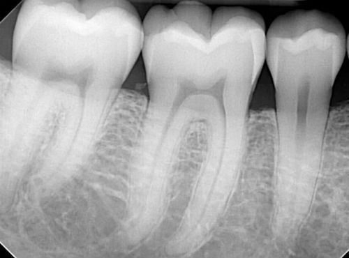 Современный рентген зуба: визиограф и его преимущества
