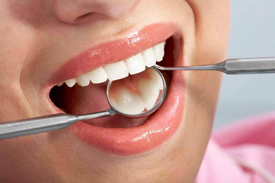 Важность процедуры профессиональной гигиены полости рта